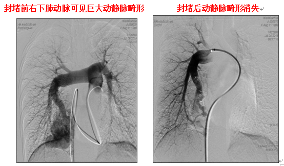 1438327488728614.png 介入.png