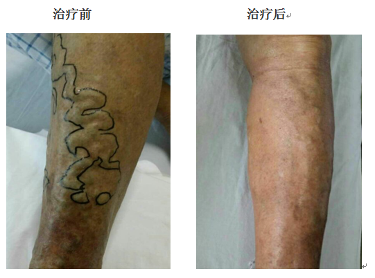 1440555138818636.png QQ截图20150826101131.png