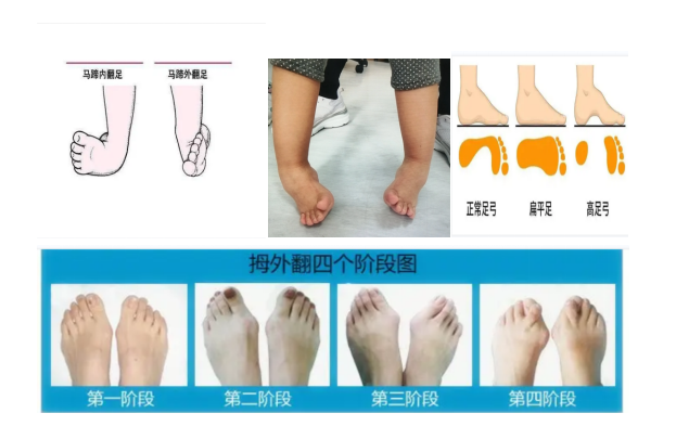 1657008847457770.png image.png